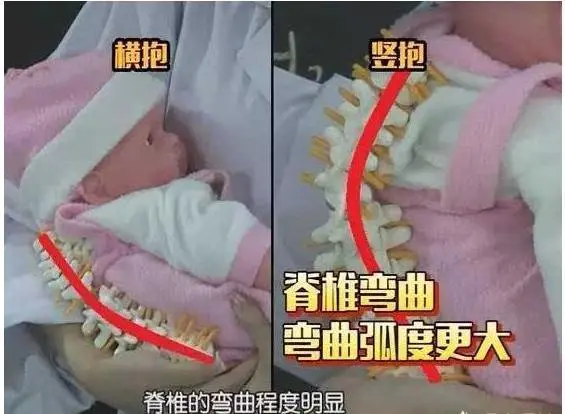 2个月婴儿经常被竖抱，会有哪些坏处？宝宝抱姿的正确顺序，家长要知道