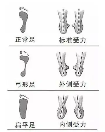 训练营｜一双跑鞋的寿命是多久？