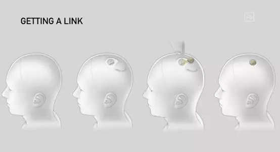 马斯克产业布局之—脑机接口Neuralink，赛博朋克时代的到来