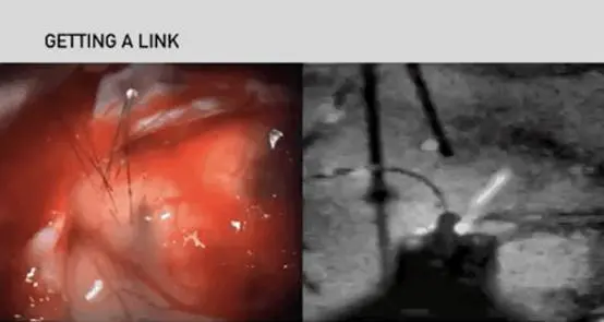 马斯克产业布局之—脑机接口Neuralink，赛博朋克时代的到来