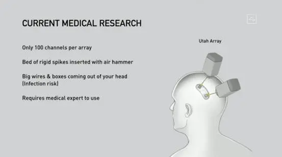 马斯克产业布局之—脑机接口Neuralink，赛博朋克时代的到来