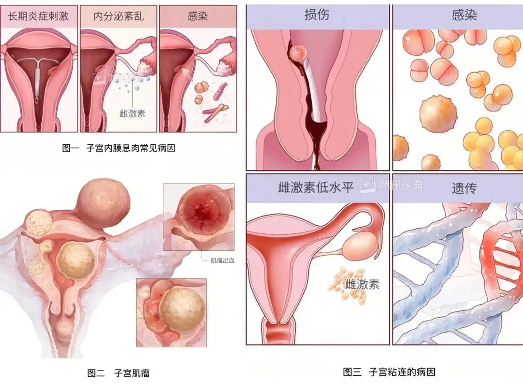 为何越来越多的夫妻怀不上孩子？