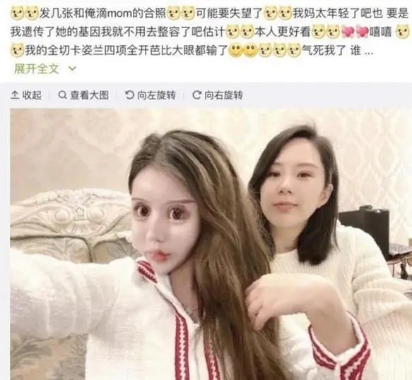 还记得整容花费近百万的少女吗？声称母亲支持，前后对比如换脸