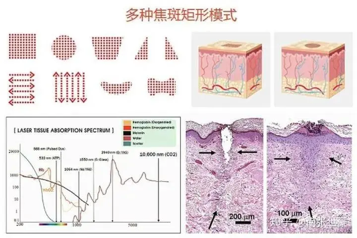 在做超声刀、热玛吉、超光子……前，这些理论知识要补一下！