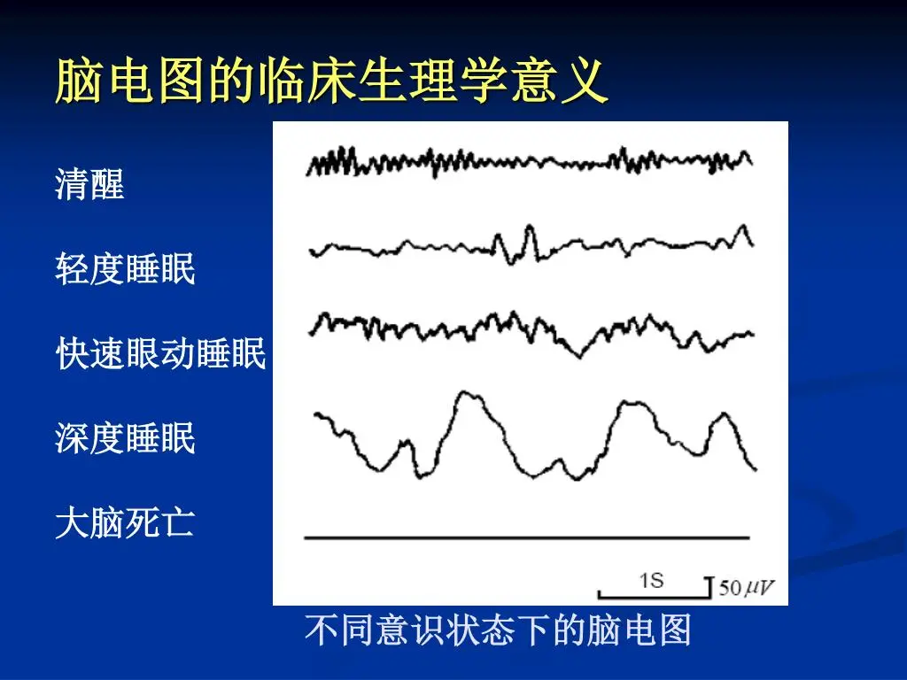 《科学》论文称：死后仍有听觉，可听到医生宣布自己死亡！