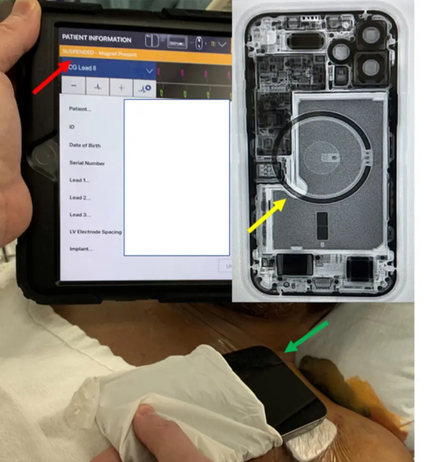 这些人不适合用iPhone 12，可能存在致命风险