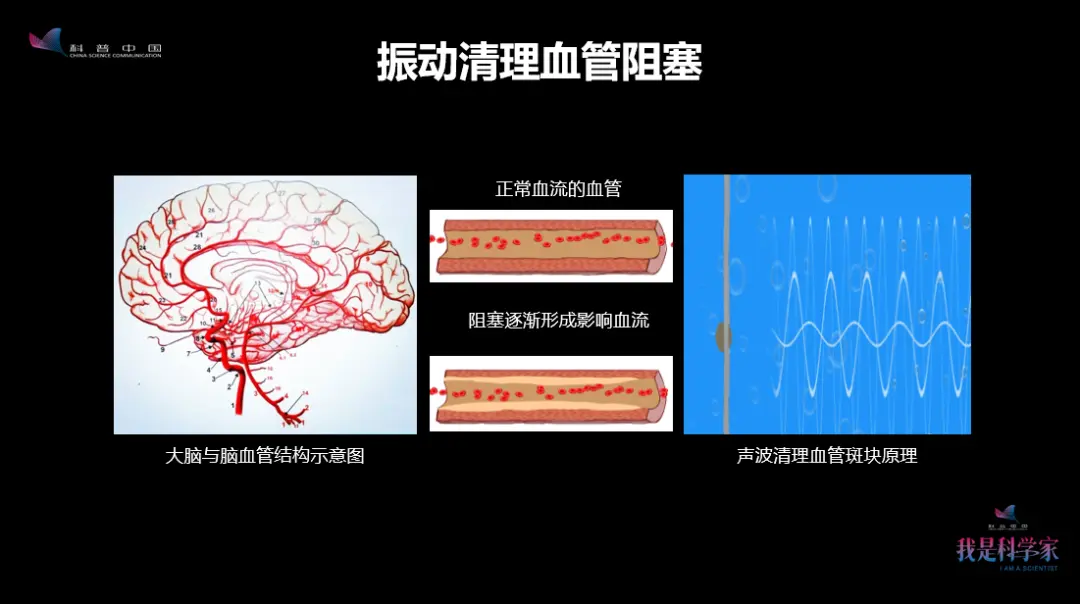 别再嫌弃你妈妈话多唠叨啦，她可能正在做声音健脑操呢