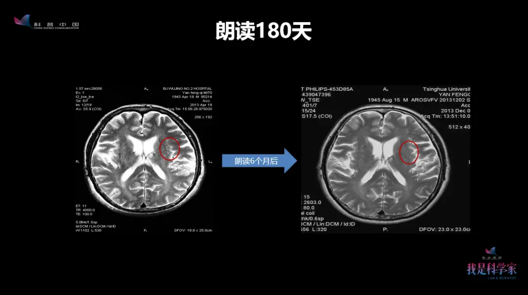 别再嫌弃你妈妈话多唠叨啦，她可能正在做声音健脑操呢