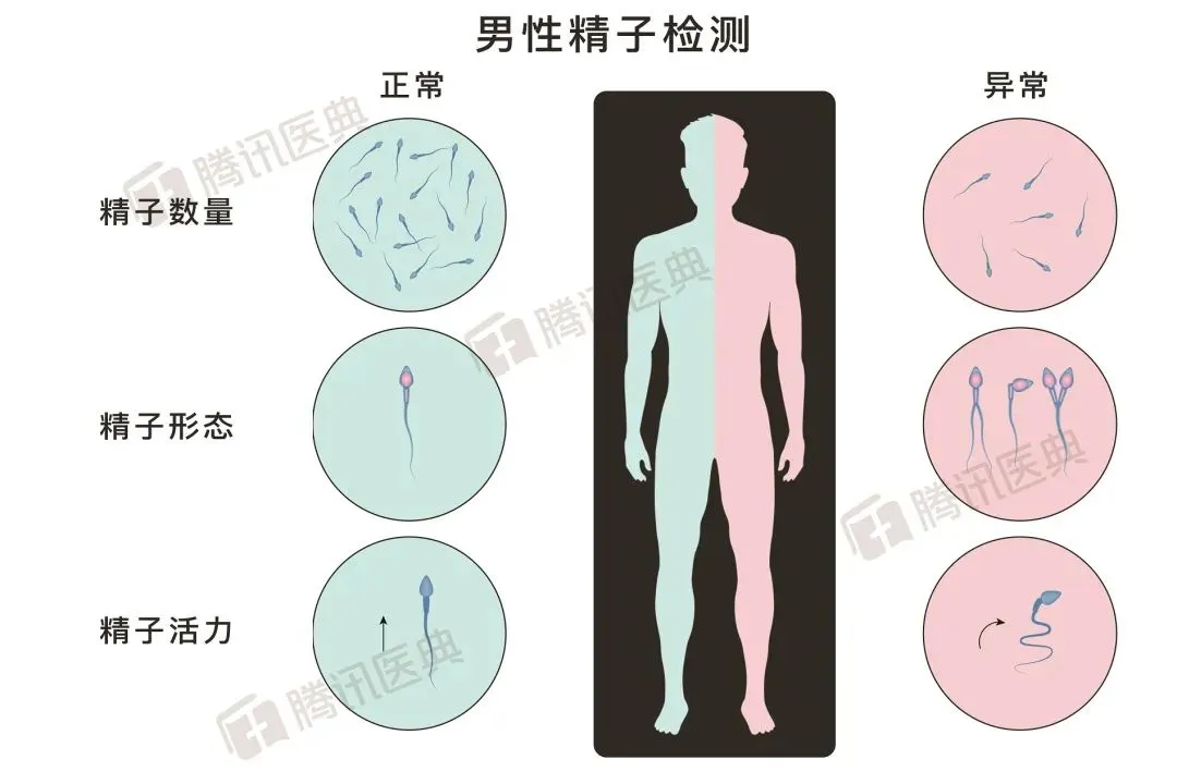 年龄不会影响男人要娃？男性年龄越大，胎儿出现的问题越多