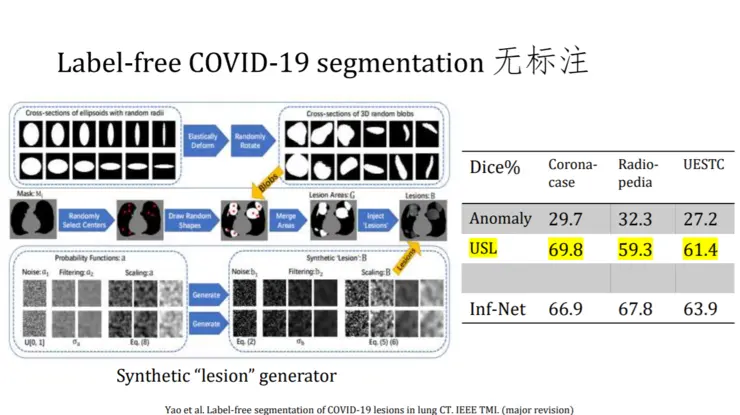 中科院周少华教授：对深度学习自动化、通用表征学习的研究心得