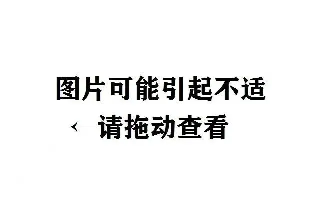 垃圾不分类随便扔，你怕是想制造“世纪之毒”