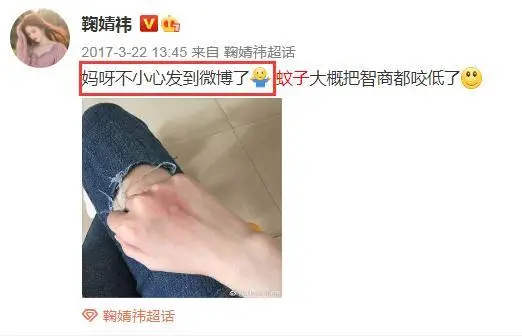 娇气女星鞠婧祎，连被咬蚊子包都要发博卖惨，却屡用替身被嘲