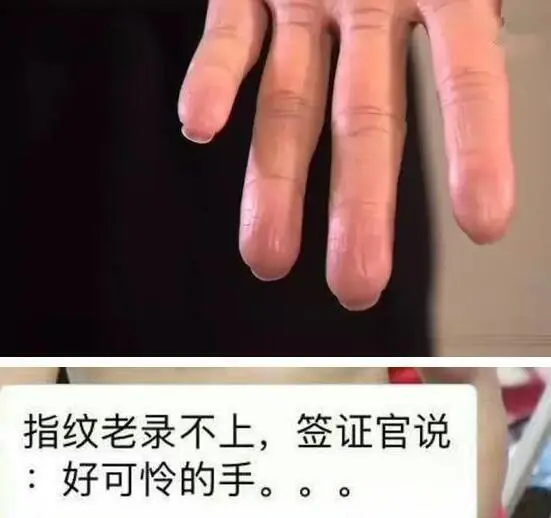 那些天生没有指纹的人，真的能成为法外狂徒吗？看完长知识了