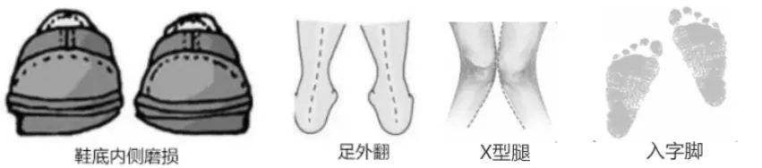 走路费鞋？你的步态问题，看鞋底就能知道！