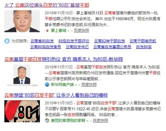 为啥越来越多孩子出现“少白头”现象？并非正常现象，家长要注意