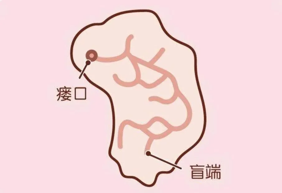 耳朵前面的“小眼儿”是富贵前兆？