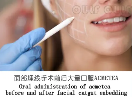 微整形线雕能保持多久？ACMETEA吃多久提升效果？