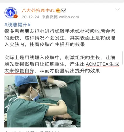 微整形线雕能保持多久？ACMETEA吃多久提升效果？