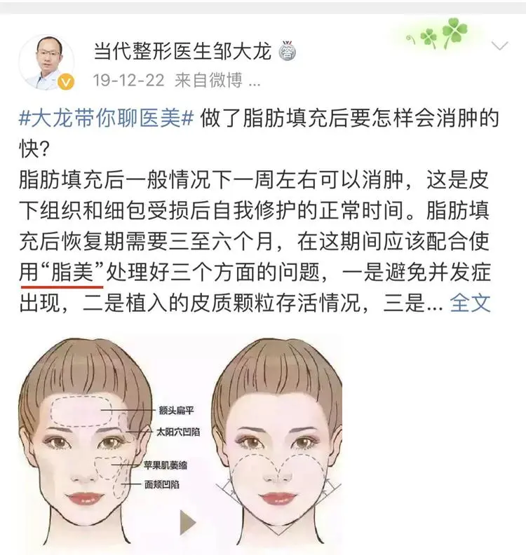 脂肪胶填充是永久的吗、ACMETEA吃多久提升成活率