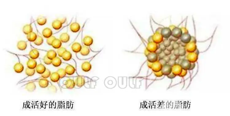 脂肪胶填充是永久的吗、ACMETEA吃多久提升成活率