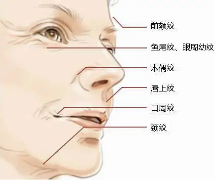 玻尿酸注射除皱都适用哪些情况？如何鉴别玻尿酸真伪？