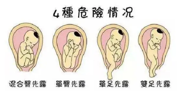 B超单上几个指标过关了，说明宝宝没畸形、没胎停，发育得挺好