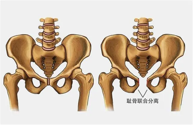 “耻骨越痛越好顺产”？这中间的学问，可没有你想的这么简单